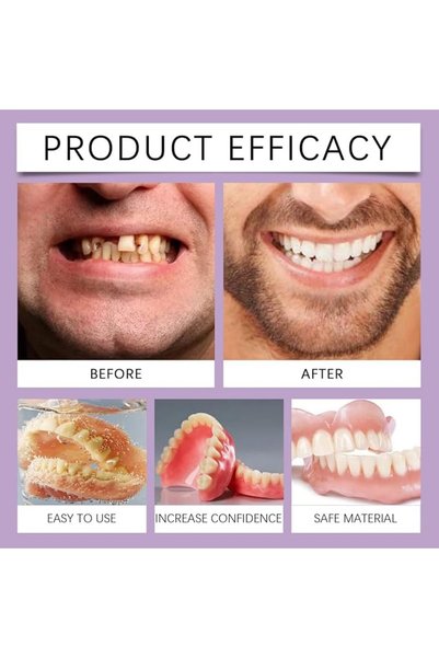 GENERAL Silicone Denture Kit - Soft Repair Kit for Artificial Teeth, Quick Full Mouth Moisturizer with Comfort Fit