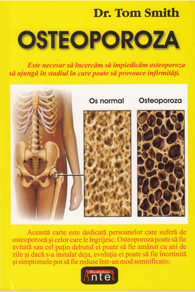 ANTET REVOLUTION Osteoporoza - Tom Smith