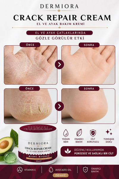 Dermiora El Ayak ve Topuk Çatlak Bakım Kremi 150 ml