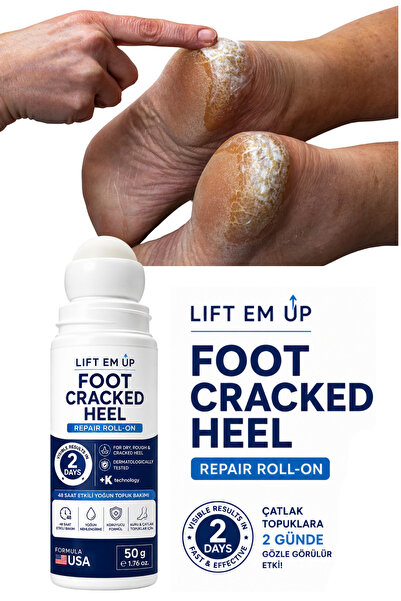 Lift Em Up Topuk Çatlak Roll-on – 48 Saat Etkili Yoğun Bakım 50 ml