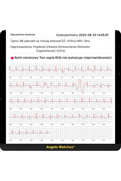 Angelo Watches SMARTWATCH CEAS BĂRBAȚI CARDIWATCH MĂSURARE ECG GLUCOZĂ HRV ME...