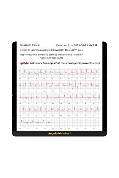 Angelo Watches SMARTWATCH CEAS BĂRBAȚI CU MĂSURAREA PRESIUNII BĂRHELICE, ECG,...