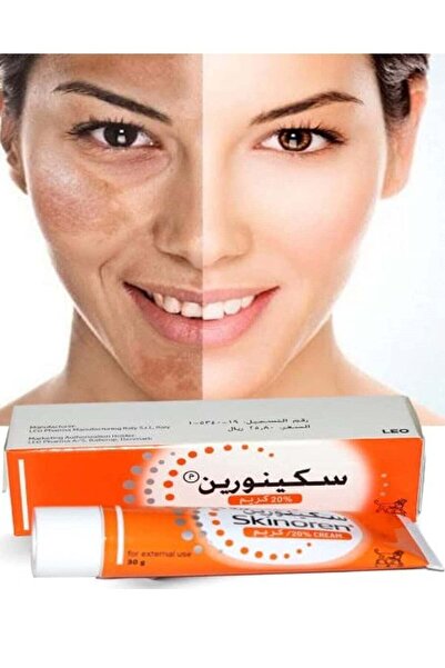 Flash drops The Skinoren Anti Acne Treatment Cream 30g