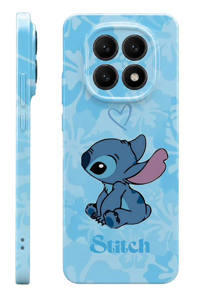 WANNA PROTECT Xiaomi Redmi Note 15 Stitch Protect Slim Parlak Tam Baskı Kamer...