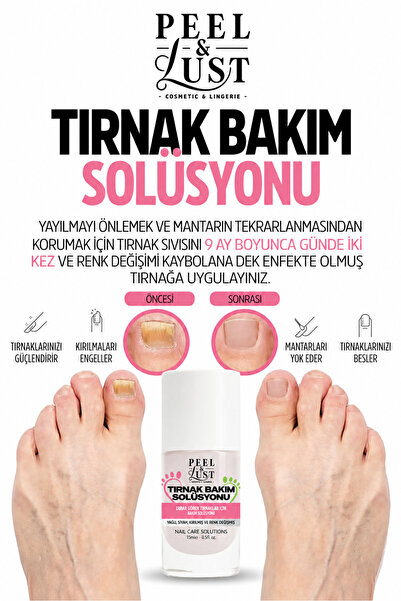 PEEL & LUST Tırnak Mantarını Gidermeye ve Tırnak Eti & Tırnak Kuvvetlendirmey...