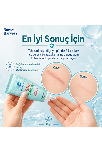 Nurse Harvey's Straderma 40 gr