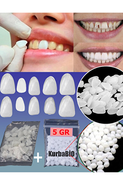 Kurbabio A1 Natural White Color 10Pcs Different Size Denture Teeth Veneers Fr...