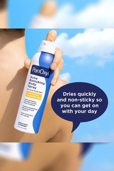 panoxyl Akne Karşıtı Vücut Spreyi 170GR