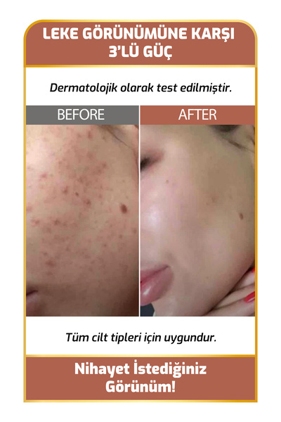New Essentials Cilt Tonu Eşitlemeye Ve Leke Gidermeye Yardımcı Cilt Serumu (VİTA-C & ARBUTİN)