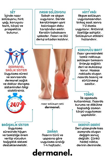 Dermanel Nasır Solüsyon Seti Siğil Solüsyon Seti