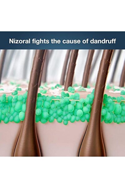 Nizoral asdm شامبو نيزورال 100 مل، شامبو علاجي مضاد للقشرة، يقشر فروة الرأس ويزيل القشور