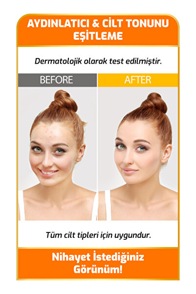 New Essentials Aydınlatıcı & Cilt Tonu Eşitlemeye Yardımcı Vitamin-C Serum (Hyaluronic Acid+ B5)