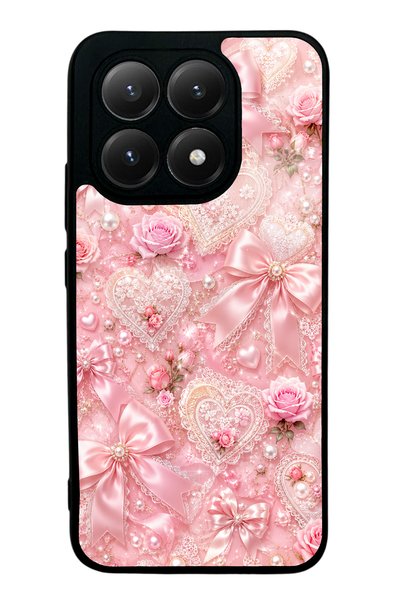 S Mode حافظة هاتف Xiaomi Mi 15T بتصميم دانتيل وردي رومانسي لامع