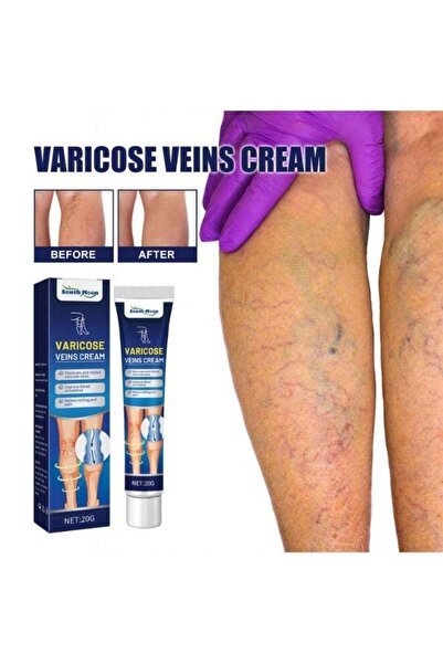 South Moon Varicose Veins Cream – Soothe, Massage & Revitalize Your Legs