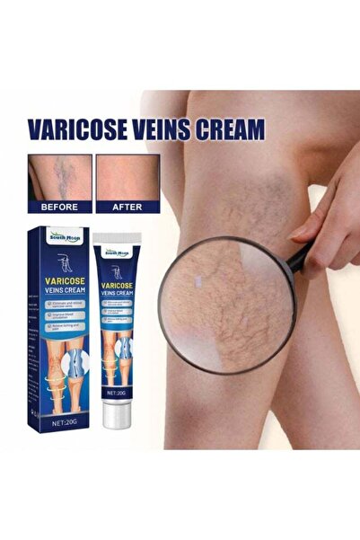 South Moon Varicose Veins Cream – Refreshing Care for Swollen & Tired Legs