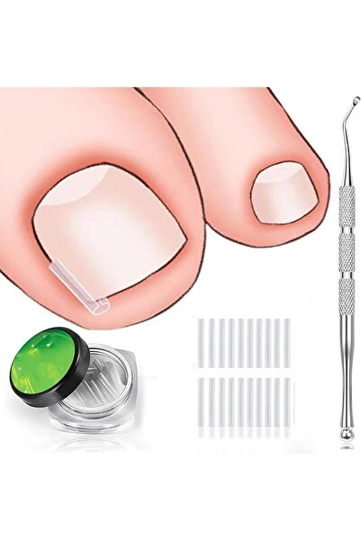 SYOSI Toenail Corrector Strips Kit, 50 Nail Isolation Pads with 1 Nail Lifter...
