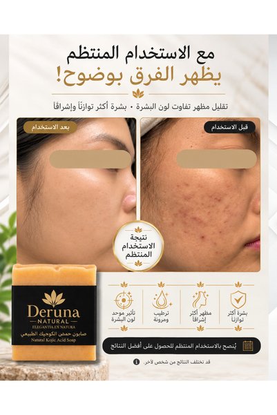 DERUNA NATURAL صابون حمض الكوجيك |   مدعوم بالكولاجين وفيتامين سي |   تفتيح البشرة ومكافحة البقع |   105 جرام