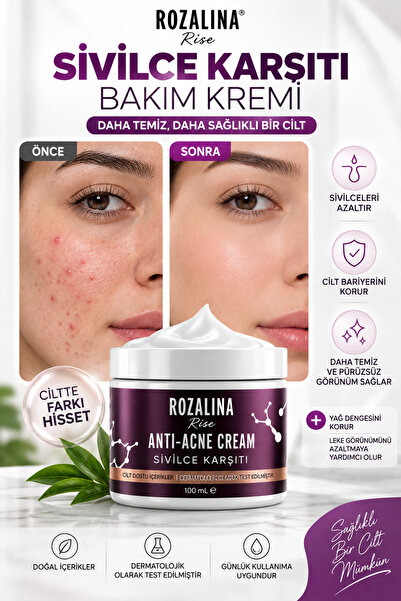 Rozalina Rise Vitamin İçeren Sîvîlce Önleyici Krem Siyah nokta ,Akne Karşıtı ...