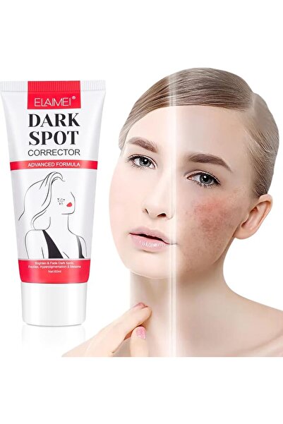 ELAIMEI Dark Spot Corrector Remover, Anti-Aging Serum Skin Brightening Cream ...