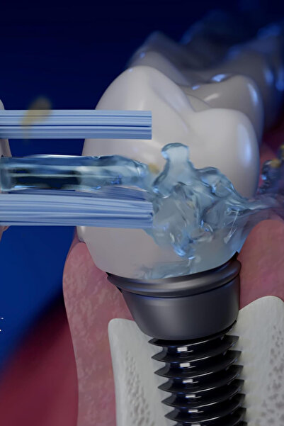 Waterpik PS-100E Plak Temizleyici Başlık 2’li Yedek Uç - Şeffaf
