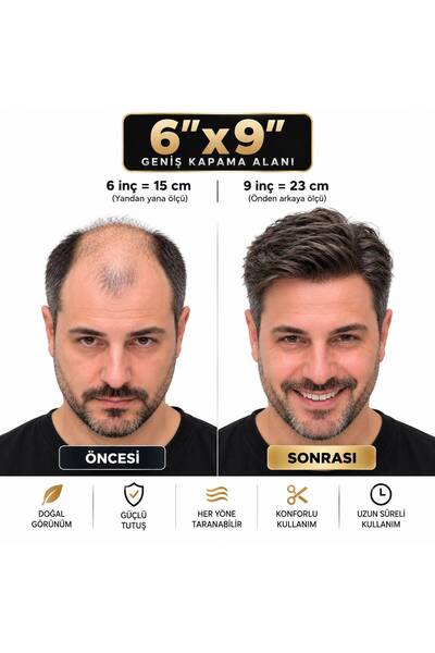 MBT HAİR PROTEZ SAÇ SİSTEMİ 6x9 – PROTEZ – SAÇ PROTEZİ – DOĞAL GÖRÜNÜMLÜ HAIR...