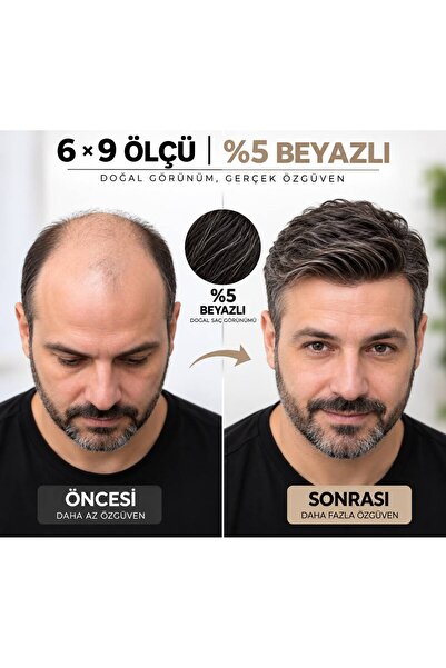 Hairtime 6×9 ÖLÇÜ %5 BEYAZLI PROTEZ SAÇ NANO ALTYAPI