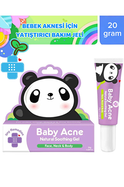 Baby Acne 20 g Bebek Aknesi ve Görünümü İçin Yatıştırıcı Jel – Yüz, Boyun ve Vücut