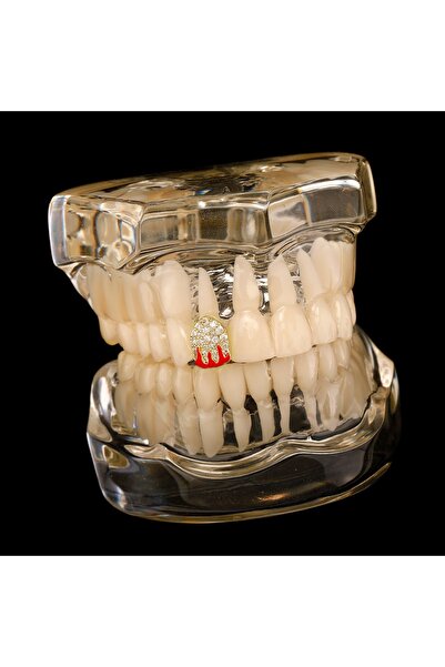 elur malta Frozen Flame Grillz ( Diş Yapınız Küçükse Tercih Etmeyiniz ! )