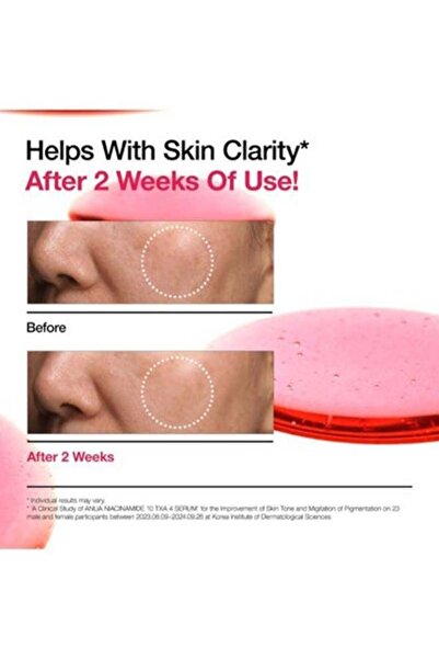 ANUA Dark Spots, Redness & Barrier Repair Solution – Niacinamide 10% + TXA 4% Serum, Azelaic Acid Redness Serum & PDRN Hyaluronic Capsule Serum (Pack of 3) 90ml