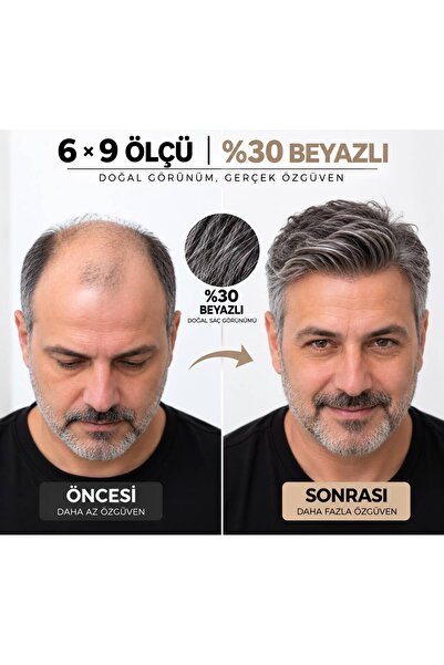 Hairtime 6×9 %30 BEYAZLI PROTEZ SAÇ – NANO TÜL ALTYAPI – HER YÖNE TARANABİLİR...