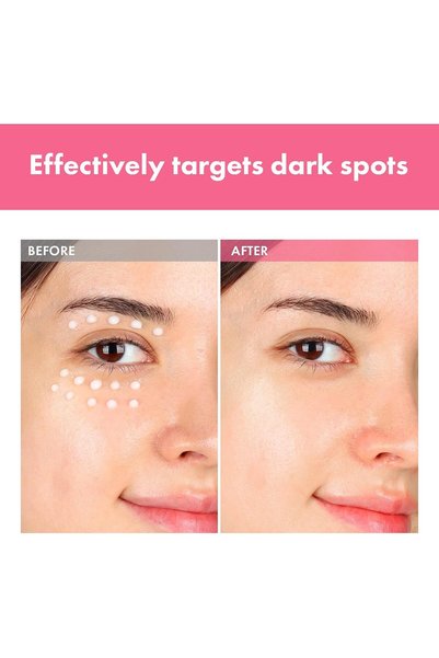 Tosowoong Arbutin 7% Intensive Spot Cream 20ml Dark Spot Corrector with 3% Tranexamic Acid 1% Niacinamide & Glutathione