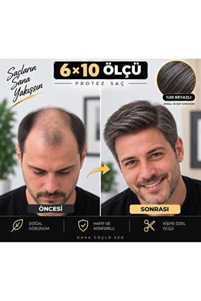 Hairtime 6×10 %20 Beyaz Protez Saç – Nano Tül Altyapı – Doğal Görünüm – Erkek...