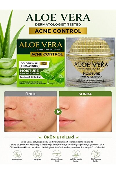 Fruit Of The Wokali Aloe Vera Moisture Anti-Acne Cream Akne, Leke ve İzleri T...