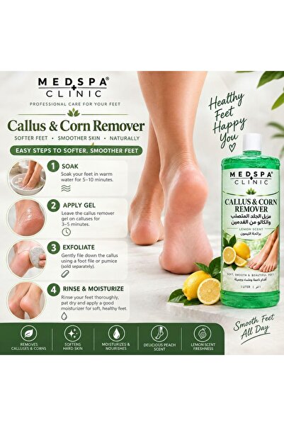 MEDSPACLINIC Callus and Corn Remover Liquid 1L – Lemon Fresh Scent Foot Care Solution, Deep Cleansing, Instantly Softens Hard Skin, Corns & Cracked Heels, Exfoliating Foot Soak for Men & Women.