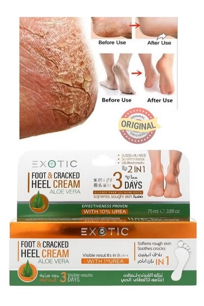 KAİZEN Aloe Vera Ve Üre Özü, Ayak Topuk Masaj Krem Peelingi, Kuru Çatlak Topu...