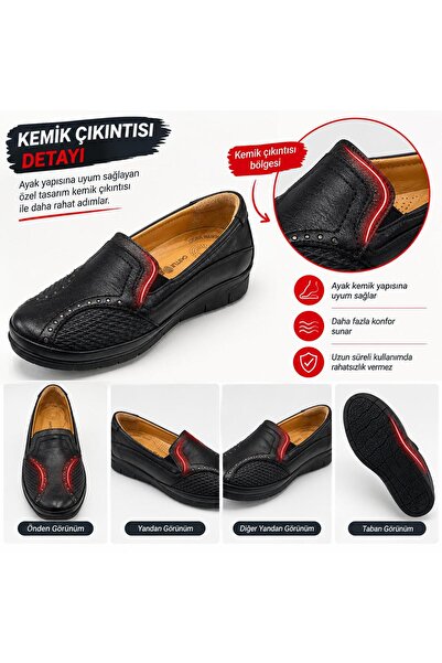 HAKİKİ DERİ KEMİK ÇIKINTISINA ÖZEL ORTOPEDİK AYAKKABI