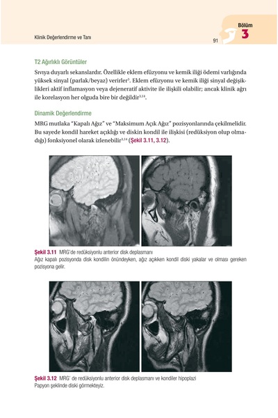 Hipokrat Kitabevi Temporomandibular Eklem Bozuklukları Tanıdan Tedaviye Güncel Yaklaşımlar