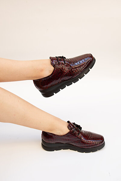 Mammamia 5531 EREN SHOES&BAG Hakiki Deri Rugan Kroko Baskılı Lastik Bağcıklı ...