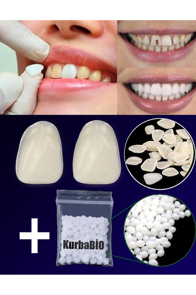 Kurbabio Laminated Composite Dental Veneer A2 Resin Rabbit Tooth 3 Grams Pro ...