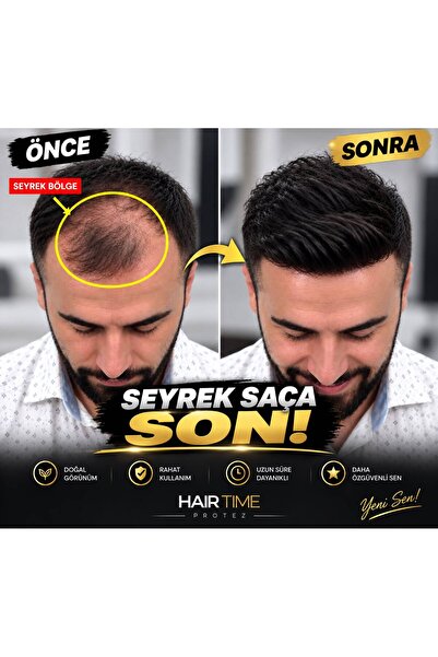 Hairtime LOKAL PROTEZ SAÇ – ÖN BÖLGE İÇİN ÖZEL ALTYAPI | DOĞAL GÖRÜNÜM | KOLA...