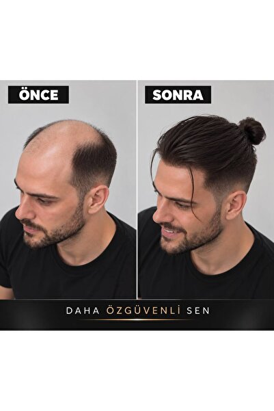 Hairtime ARKADAN BAĞLANABİLİR MODEL – STANDART ÖLÇÜ PROTEZ SAÇ | DOĞAL GÖRÜNÜM