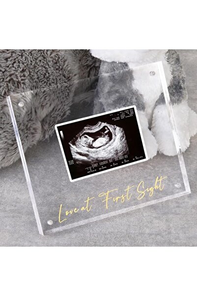 GENERAL Acrylic Ultrasound Picture Frame, Bright Photo Frame, Sonogram Love a...