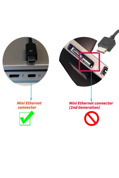 Choice Check remark ThinkpadX1 Ethernet adapter ThinkPad X1 Carbon RJ45 Netwo...