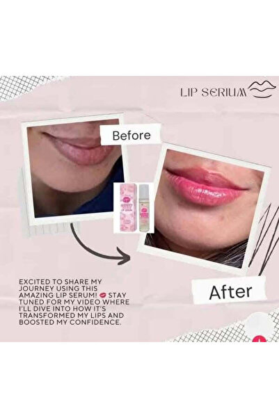K- Beauty سيروم الشفاه سويت كيس من كي-بيوتي 10 مل