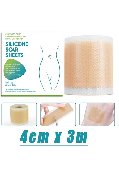 Choice 4cm x 3m 4CM X 3M Silicone Scar Sheets Self-Adhesive Stretch Mark Tape...