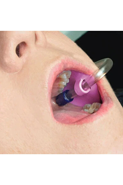 Choice 10pcs Autoclavable Dental Suction Tube Holder Oral Care Tools Saliva E...