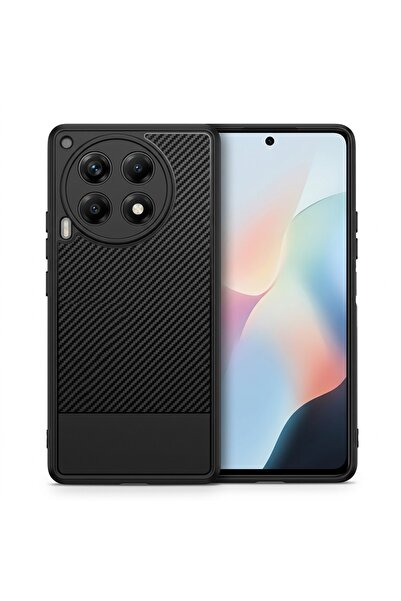 Nezih Case Tecno Camon 30 ile Uyumlu Karbon Desenli Darbe Korumalı Kılıf