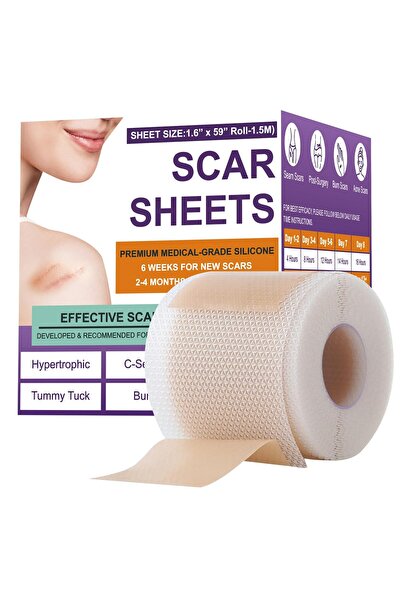 Choice1 1rollX1.5M 0.5M/1.5M/3M*4cm Silicone Scar Sheets Removal Strips Silic...