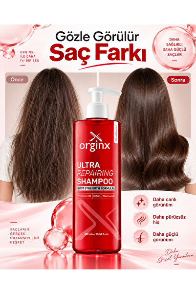 Orginx Saç Dökülmesine Karşı Hızlı Saç Uzatan Dolgunlaştırıcı Onarıcı & Güçlendirici Şampuan 400 ml – Kafein, Niacinamide, Provitamin B5