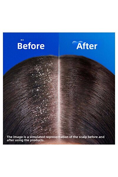 Head & Shoulders Șampon anti-mătreață Classic Care 330 ml